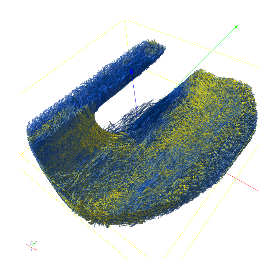 Analysis results for a region of interest CT data set of a break pipe clip. 3D visualization of local deviation fiber direction from global mean fiber direction. Yellow marks deviations larger than 20°. 