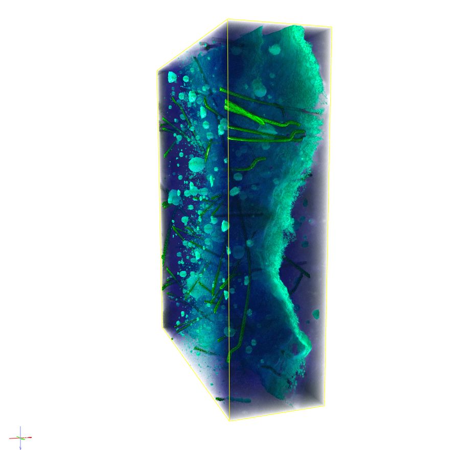 Visualization of the same crack in the CT image.